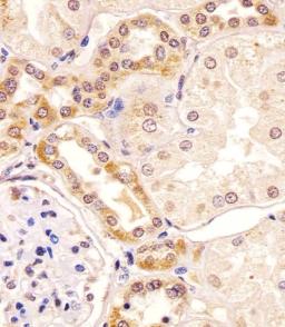 Antibody staining PKC beta1/2 in human kidney tissue sections by Immunohistochemistry (IHC-P - paraformaldehyde-fixed, paraffin-embedded sections).