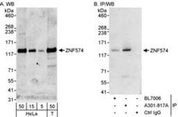 Detection of human ZNF574 by western blot and immunoprecipitation.