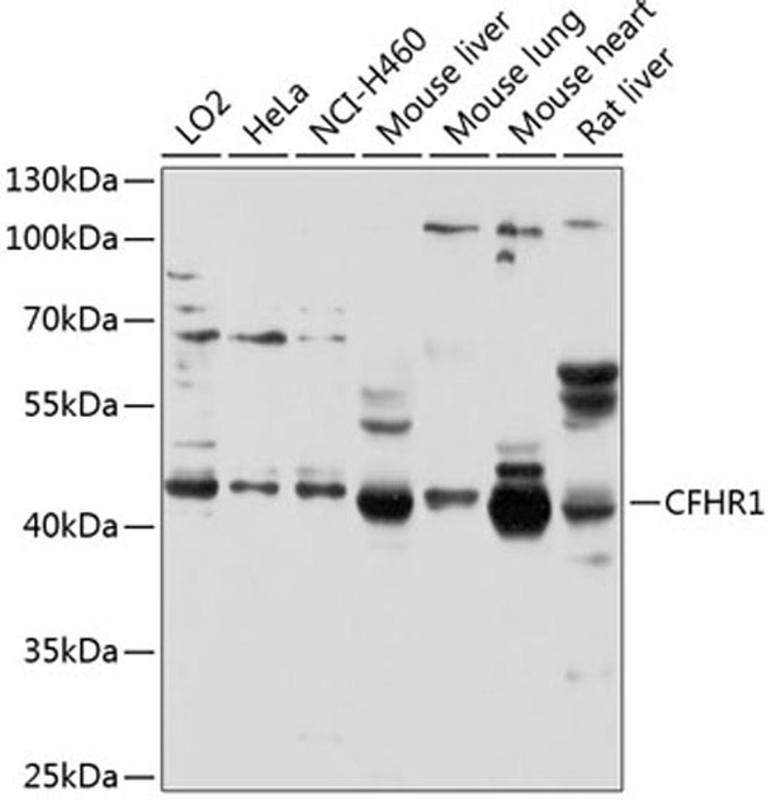 Western blot - CFHR1 antibody (A2743)