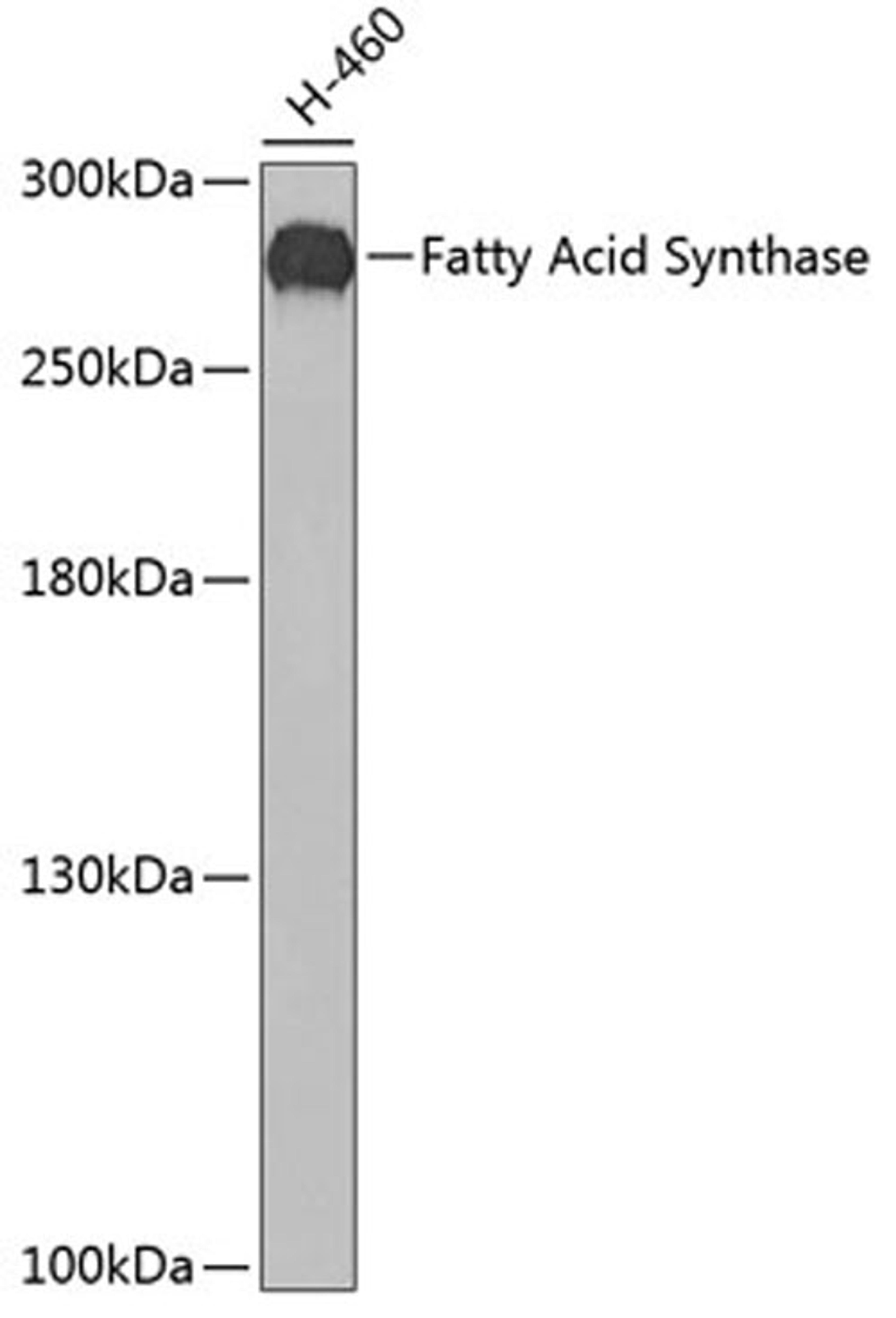 Western blot - Fatty Acid Synthase antibody (A0462)