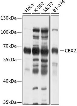 Western blot - CBX2 antibody (A2683)