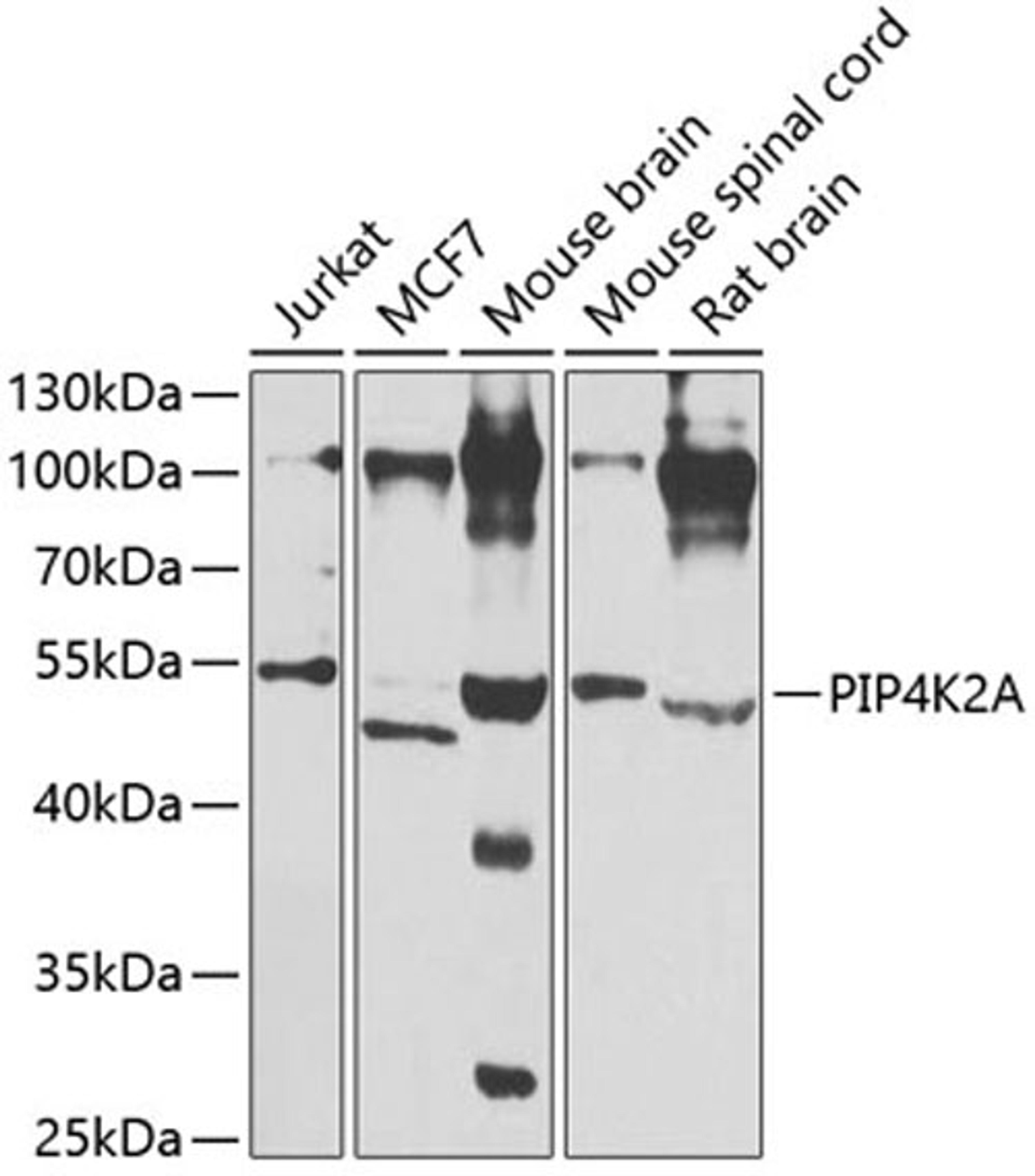 Western blot - PIP4K2A antibody (A7446)