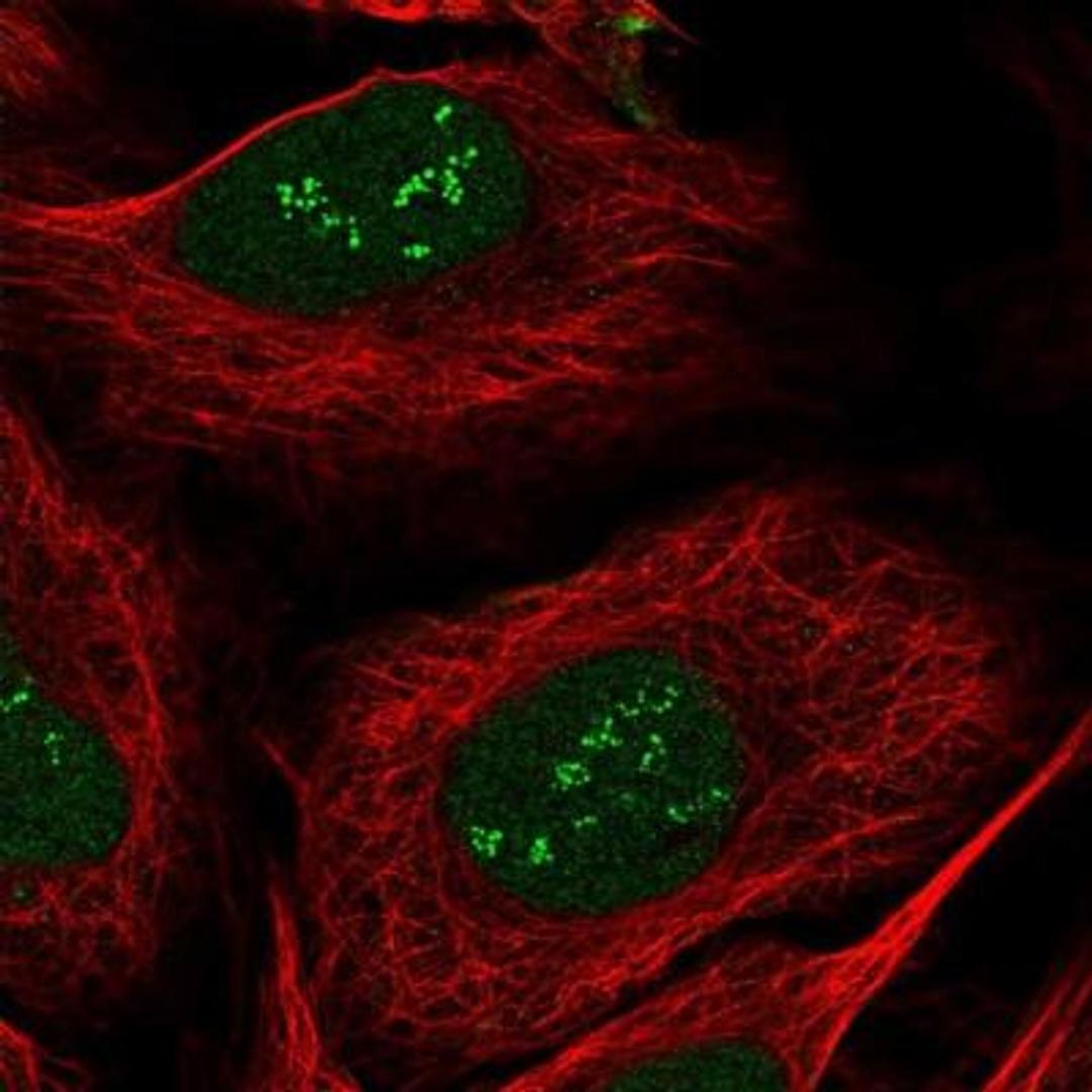 Immunofluorescence: sen15 Antibody [NBP1-89888] - Staining of human cell line U-2 OS shows positivity in nucleus & nucleoli.