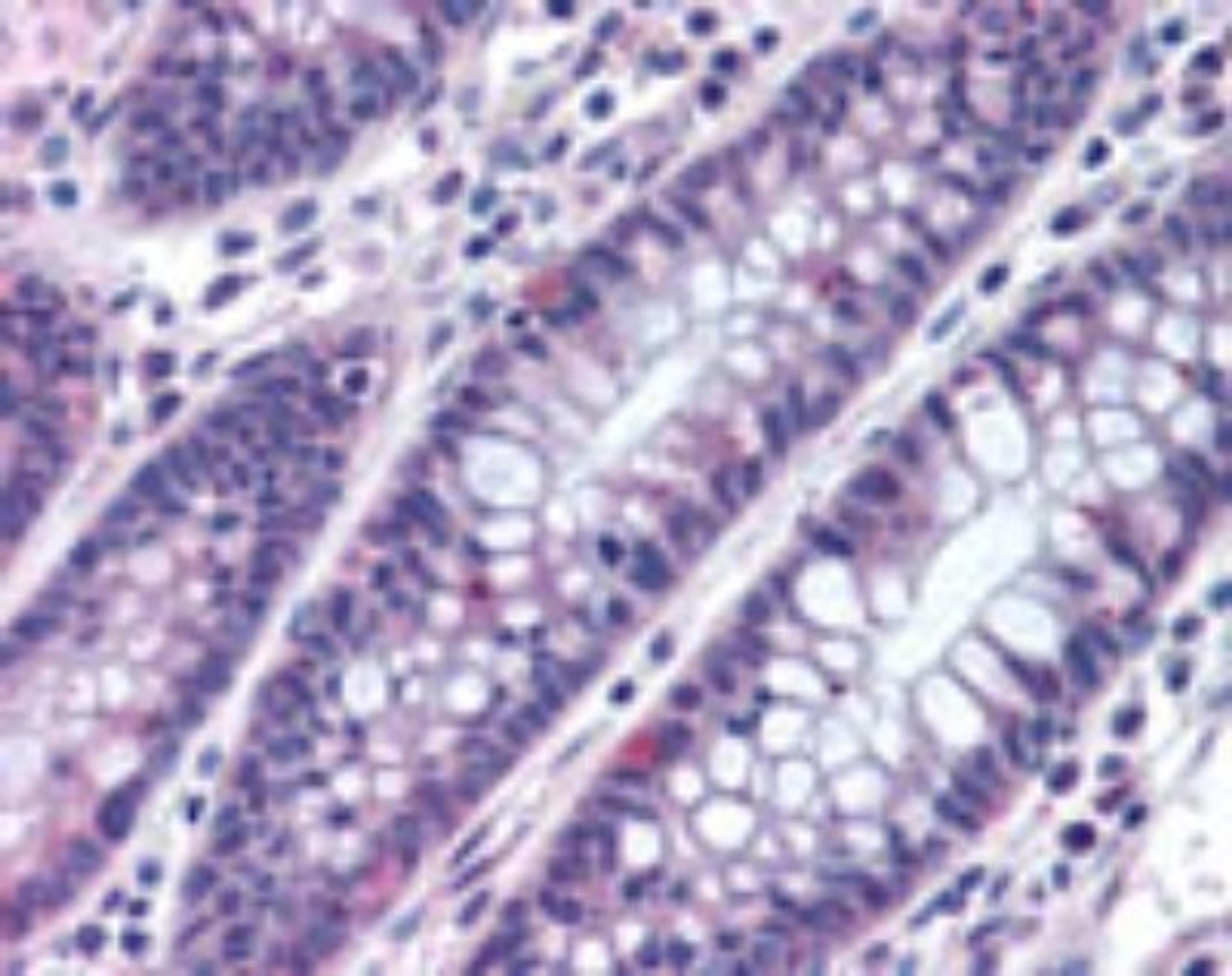 Immunohistochemistry-Paraffin: MTSS1 Antibody [NBP2-24716] - analysis of human colon using this antibody at 10 ug/ml.