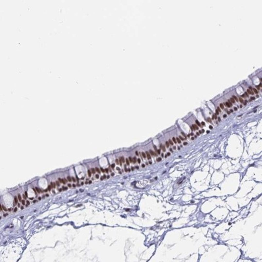 Immunohistochemistry: PBX2 Antibody [NBP2-31853] - Staining of human nasopharynx shows strong nuclear positivity in respiratory epithelial cells.