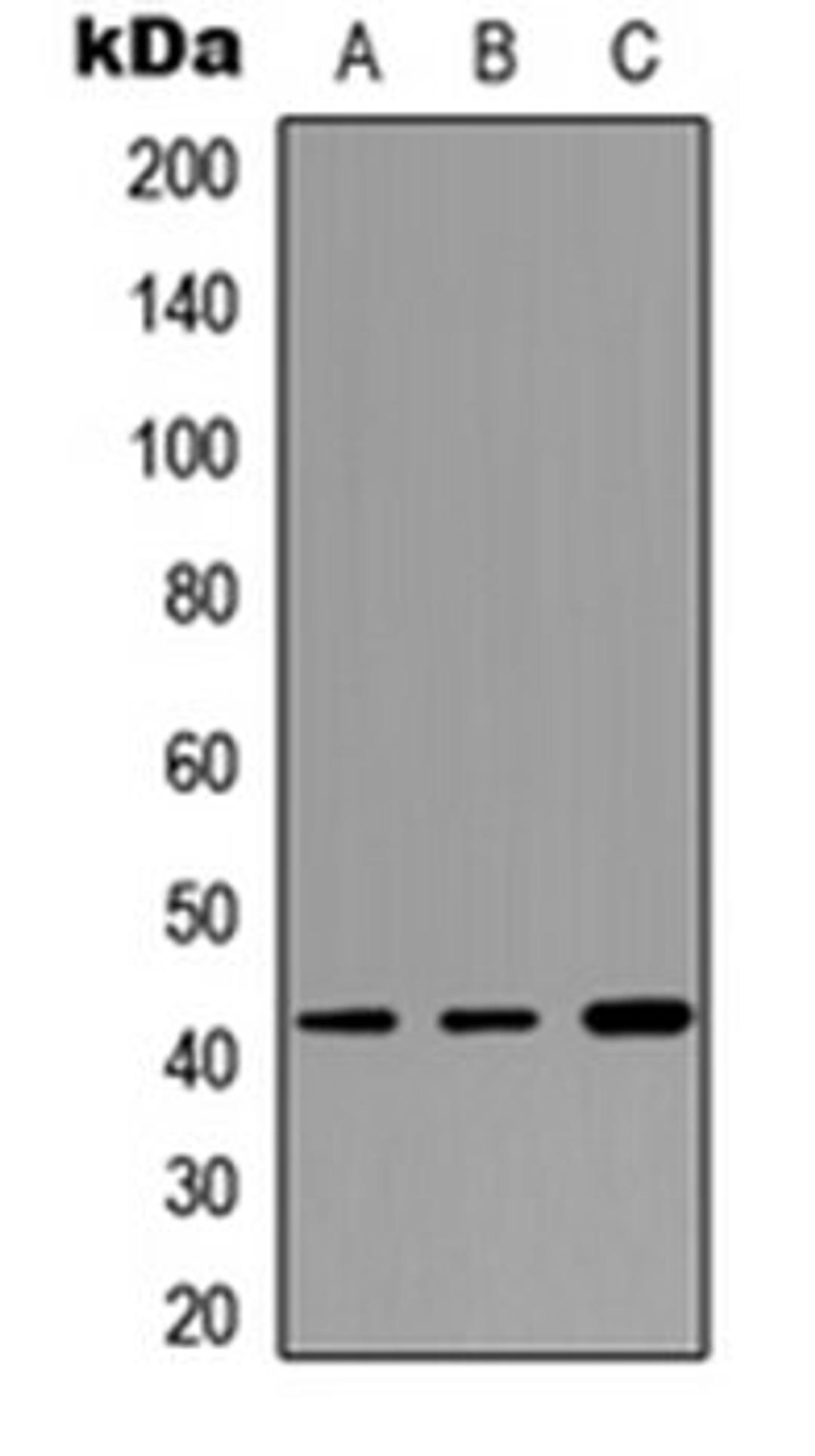 Western blot analysis of HEK293T (Lane 1), NIH3T3 (Lane 2), PC12 (Lane 3) whole cell lysates using Cathepsin W antibody