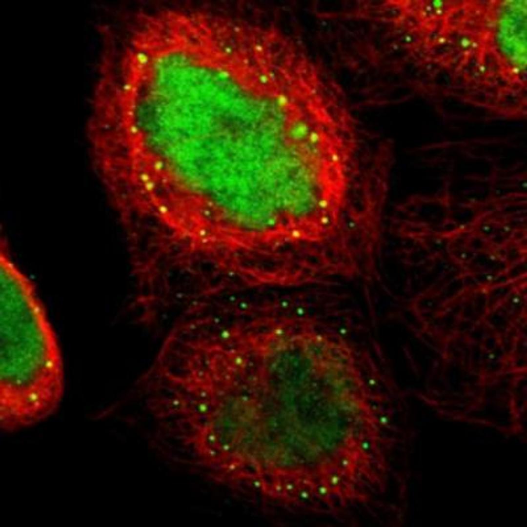 Immunofluorescence: ELFN2 Antibody [NBP1-90569] - Staining of human cell line A-431 shows positivity in vesicles & nucleus but excluded from the nucleoli. Antibody staining is shown in green.