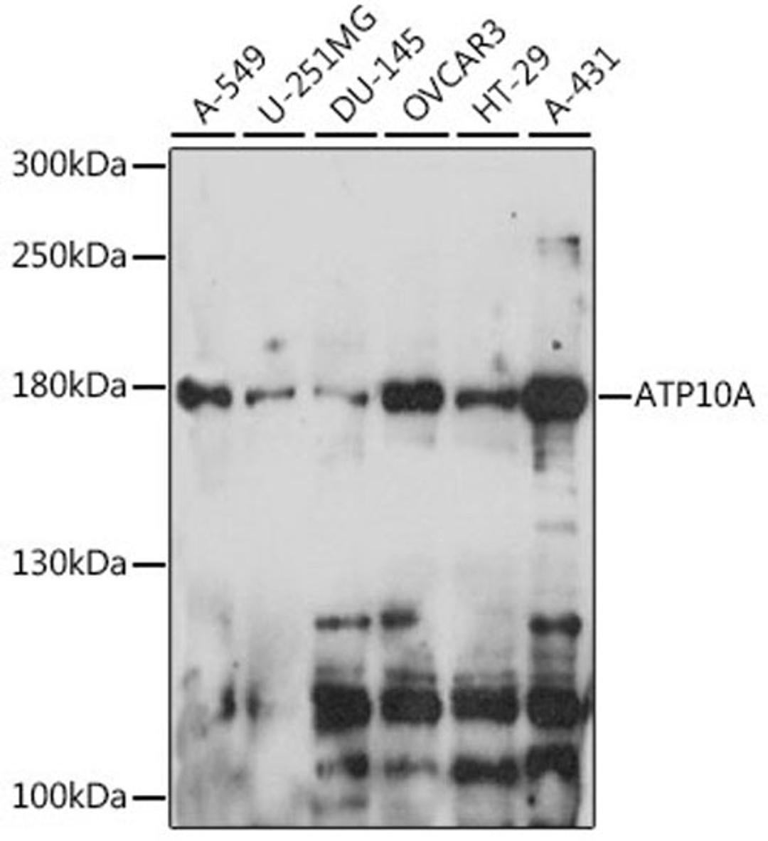 Western blot - ATP10A antibody (A15873)