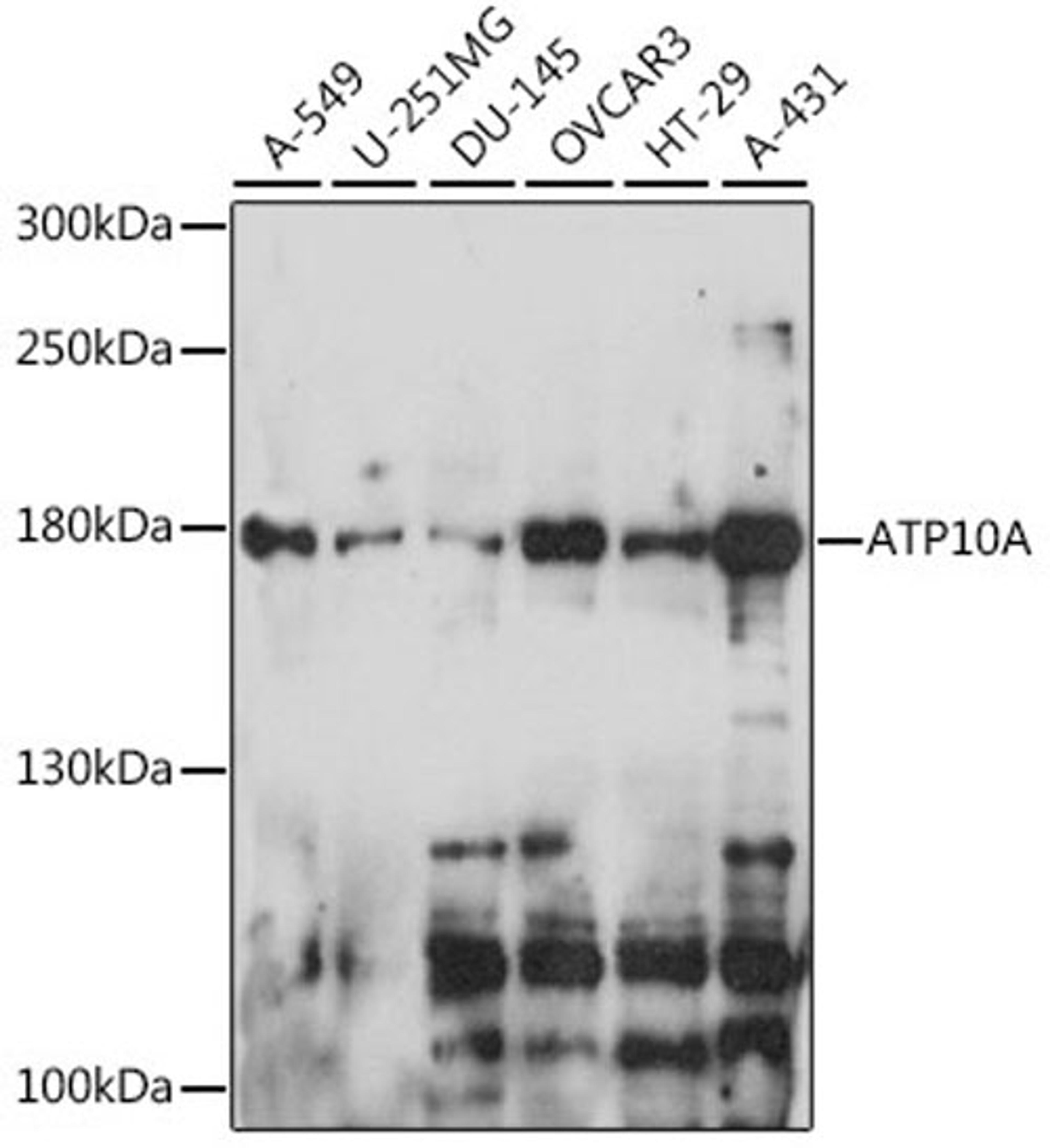 Western blot - ATP10A antibody (A15873)