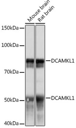 Western blot - DCAMKL1 Rabbit mAb (A4372)