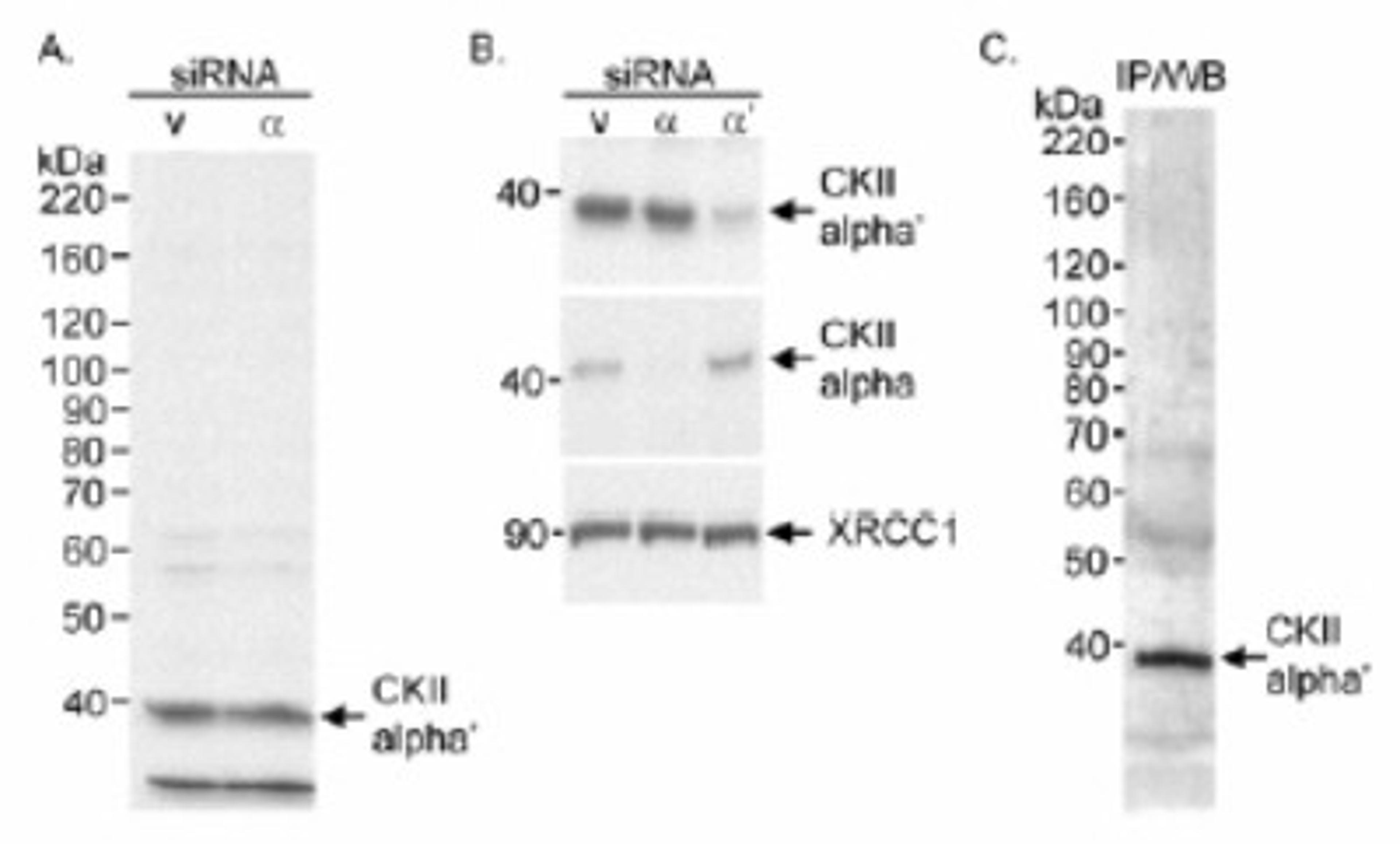 Western Blot: CKII alpha prime polypeptide Antibody [NB100-379] - Detection of Human CKII Alpha on HeLa WCL using NB100-379. IPed CKII alpha was detected using another goat anti-CKII alpha antibody. CKII alpha and XRCC1 were detected with NB100-379.