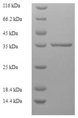 (Tris-Glycine gel) Discontinuous SDS-PAGE (reduced) with 5% enrichment gel and 15% separation gel.