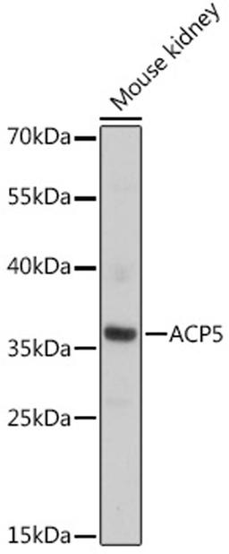 Western blot - ACP5 antibody (A16338)