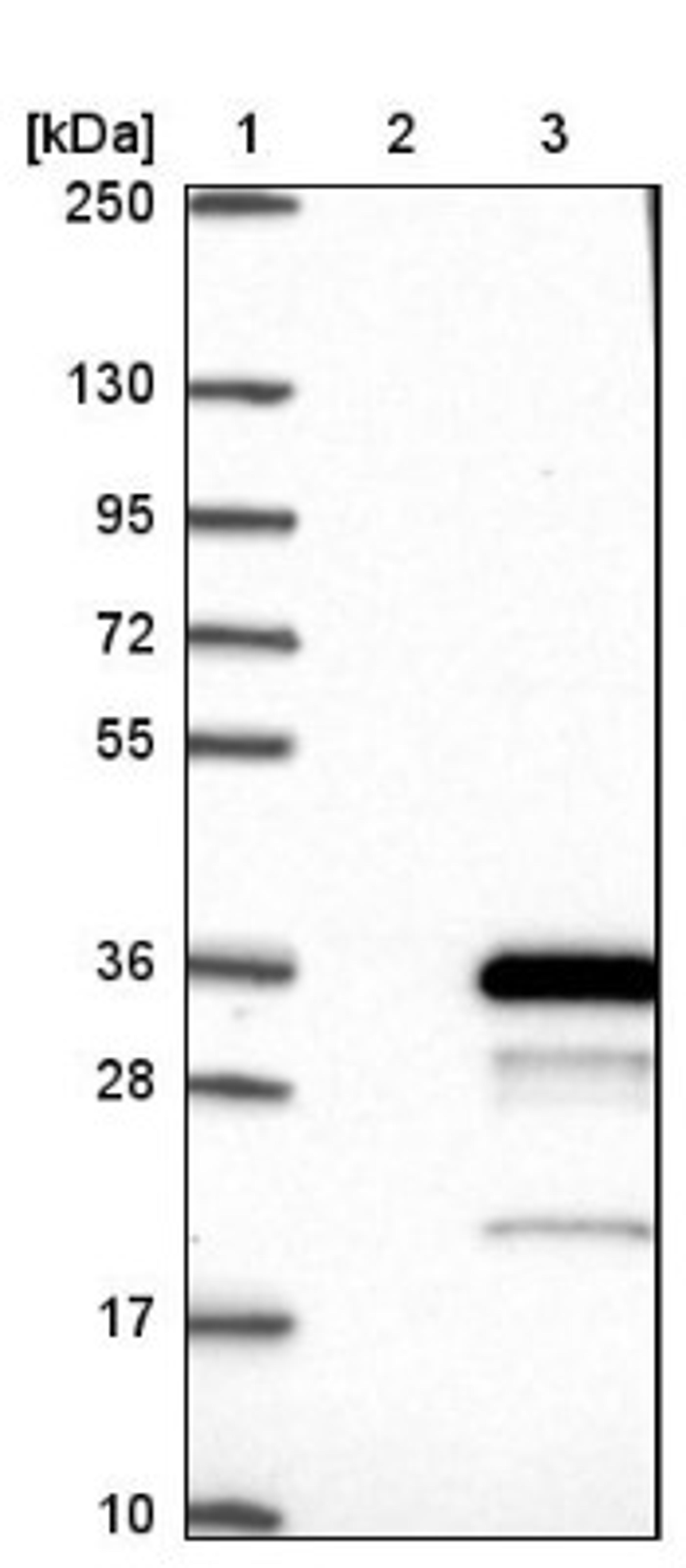 Western Blot: HAND1 Antibody [NBP1-88636] - Lane 1: Marker [kDa] 250, 130, 95, 72, 55, 36, 28, 17, 10<br/>Lane 2: Negative control (vector only transfected HEK293T lysate)<br/>Lane 3: Over-expression lysate (Co-expressed with a C-terminal myc-DDK tag (~3.1 kDa) in mammalian HEK293T cells, LY417727)