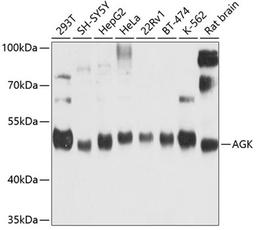 Western blot - AGK antibody (A9976)