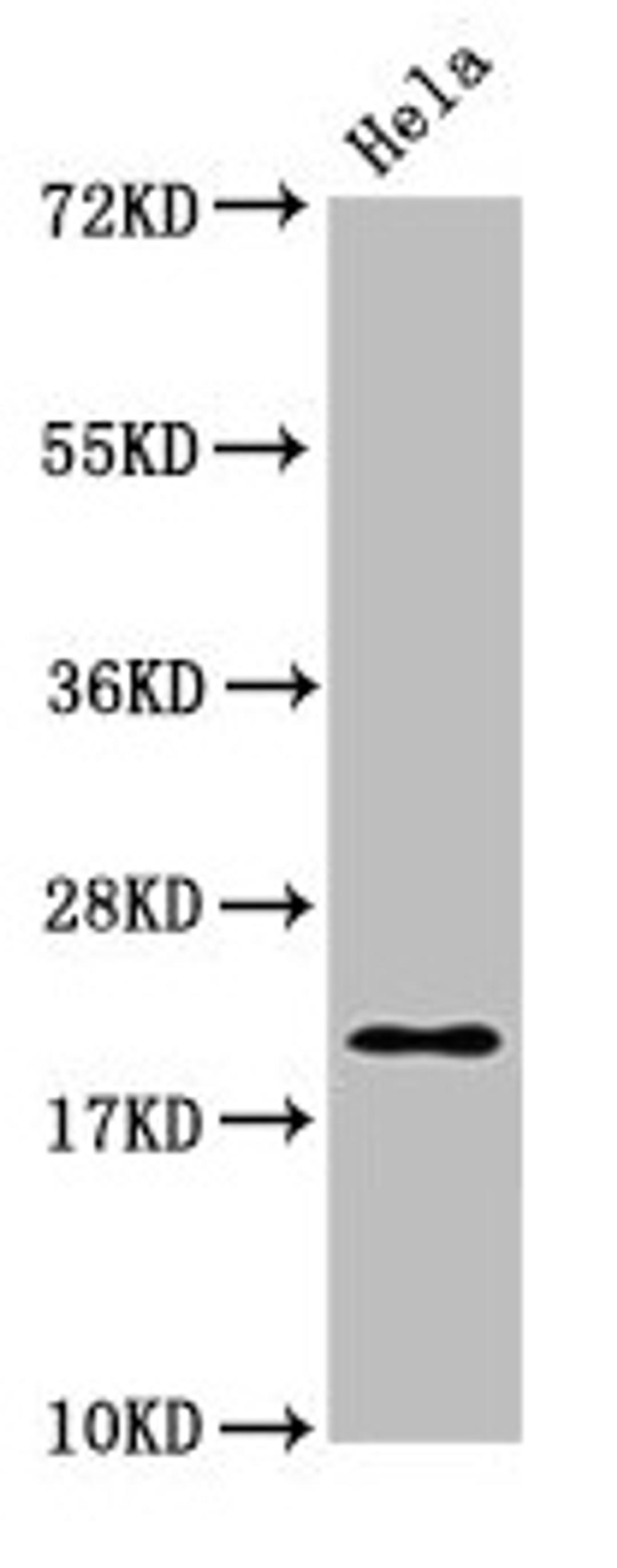 Western Blot. Positive WB detected in: Hela whole cell lysate. All lanes: MOBP antibody at 4µg/ml. Secondary. Goat polyclonal to rabbit IgG at 1/50000 dilution. Predicted band size: 21, 10, 24 kDa. Observed band size: 21 kDa