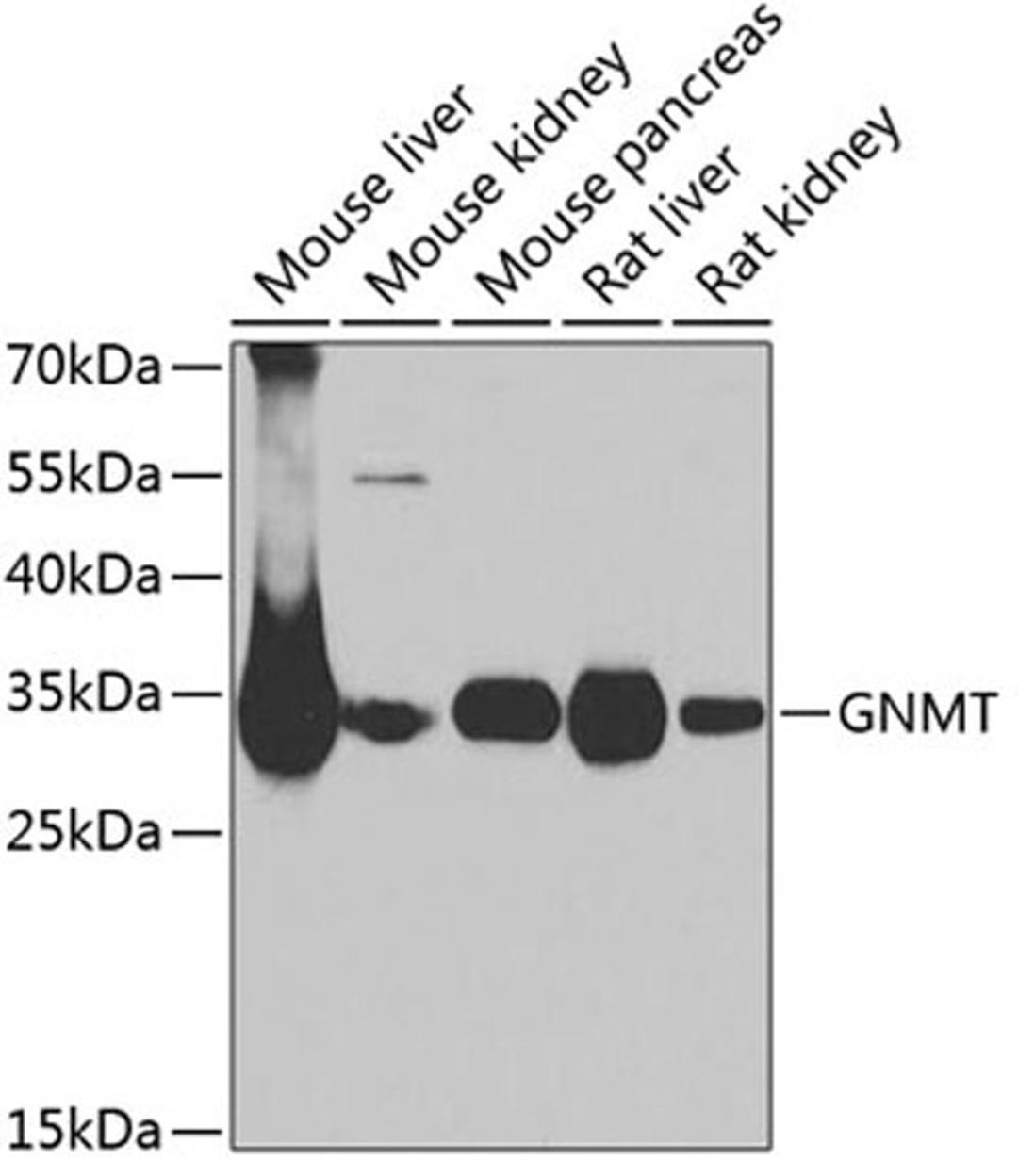 Western blot - GNMT antibody (A6608)