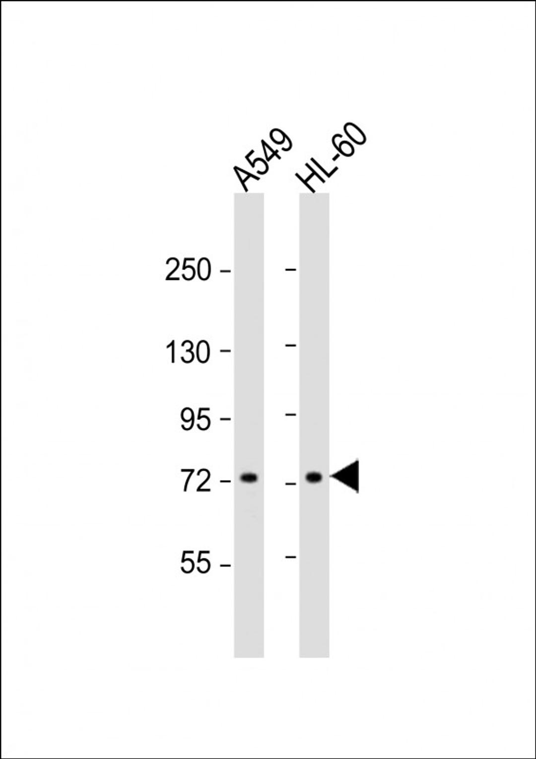 Western Blot at 1:1000 dilution Lane 1: A549 whole cell lysate Lane 2: HL-60 whole cell lysate Lysates/proteins at 20 ug per lane.