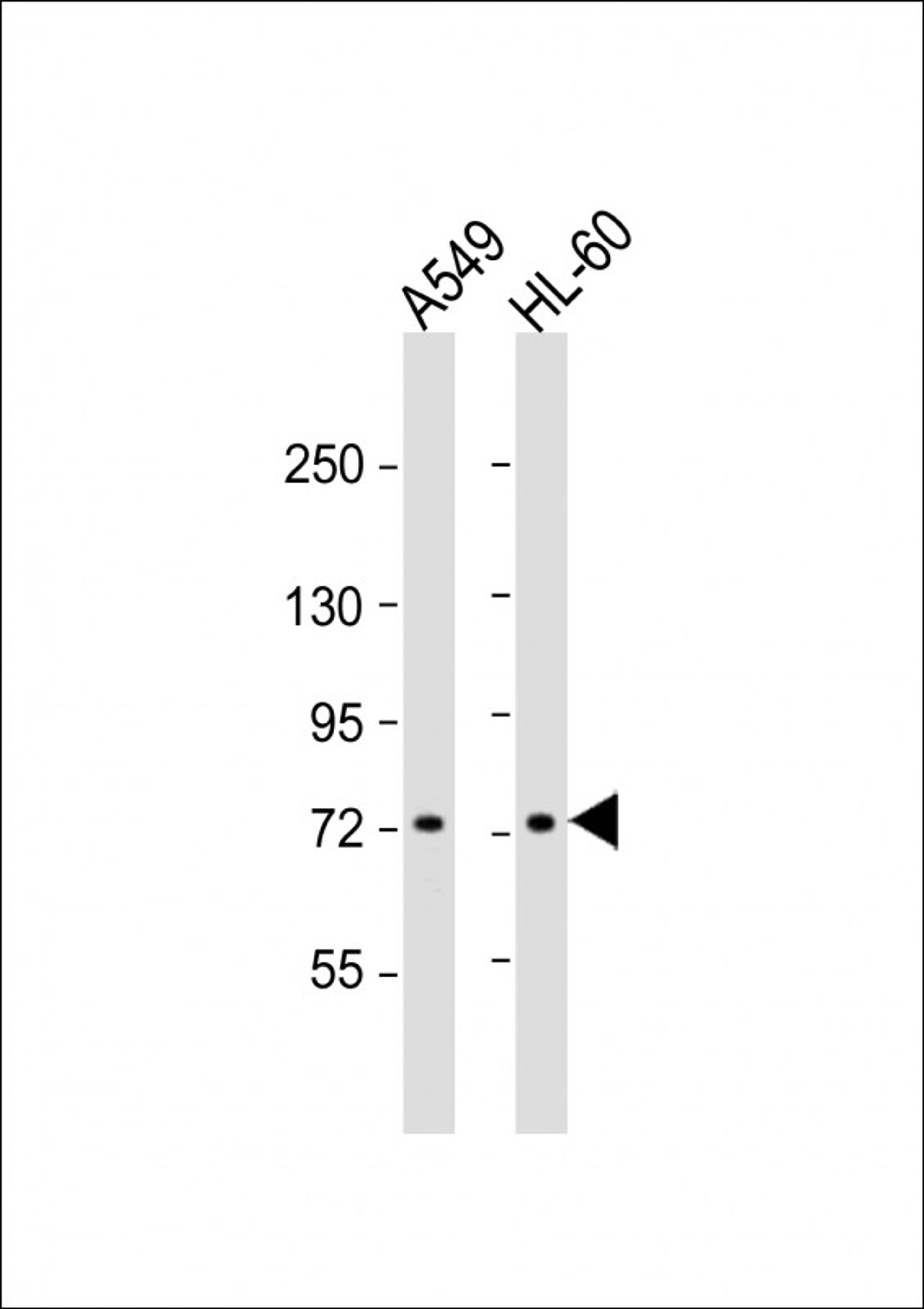 Western Blot at 1:1000 dilution Lane 1: A549 whole cell lysate Lane 2: HL-60 whole cell lysate Lysates/proteins at 20 ug per lane.