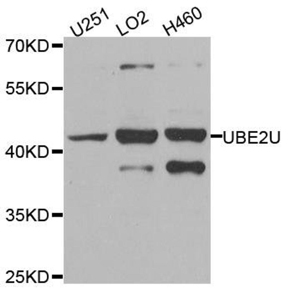 Western blot analysis of extracts of various cell lines using UBE2U antibody