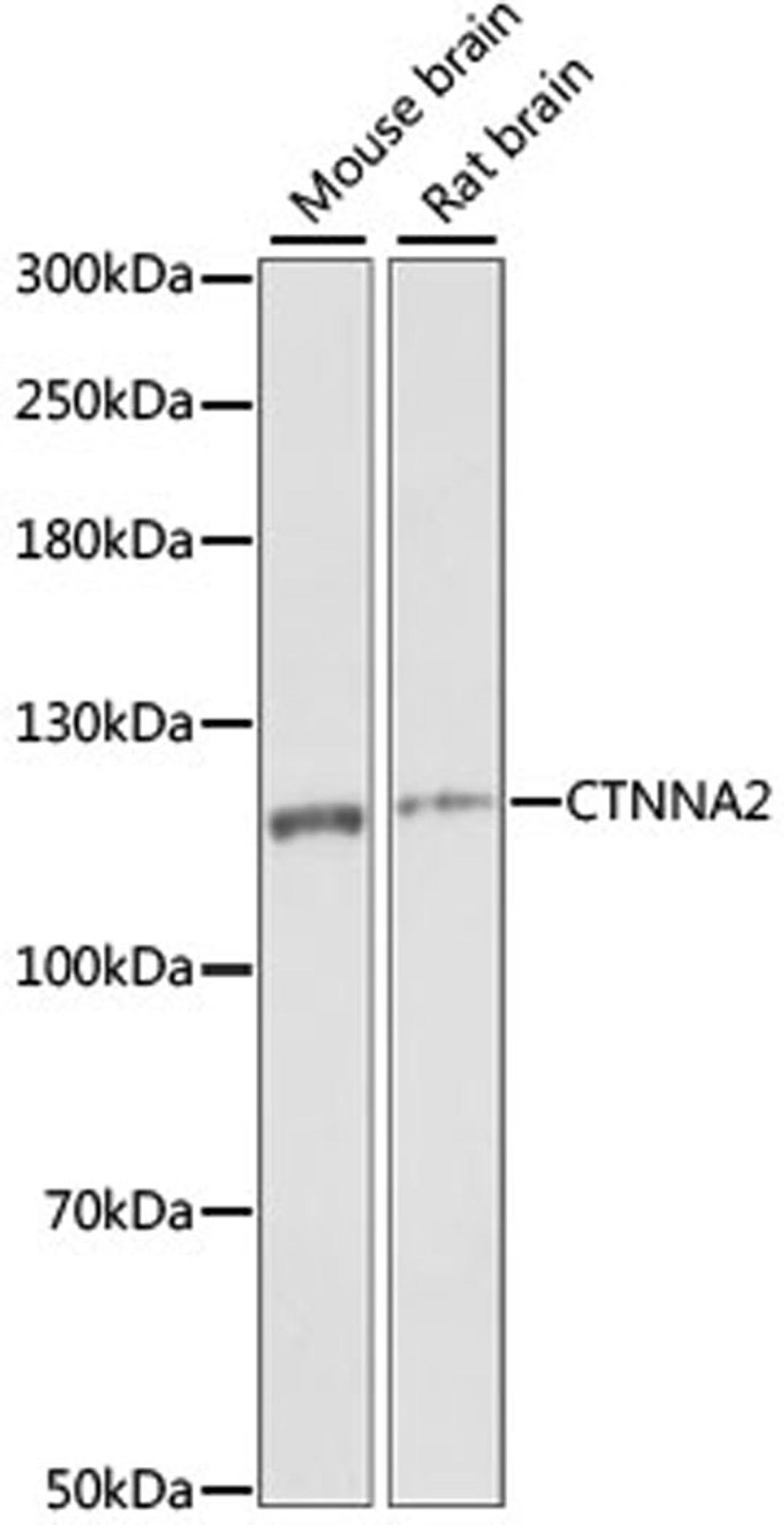 Western blot - CTNNA2 antibody (A15269)