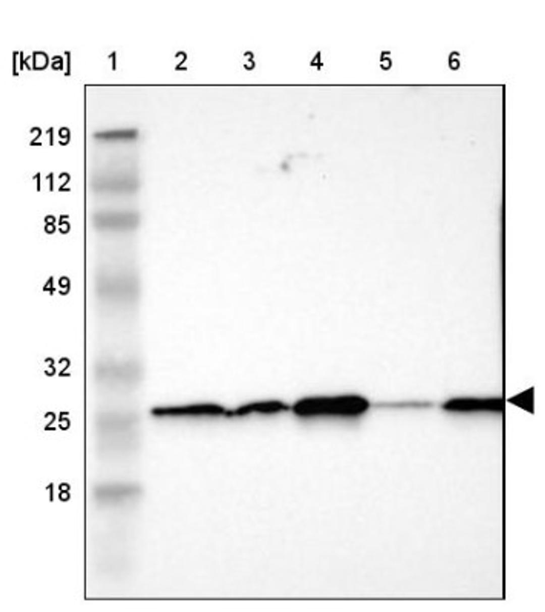 Western Blot: SNAP23 Antibody [NBP1-83162] - Lane 1: Marker [kDa] 219, 112, 85, 49, 32, 25, 18<br/>Lane 2: Human cell line RT-4<br/>Lane 3: Human cell line U-251MG sp<br/>Lane 4: Human cell line A-431<br/>Lane 5: Human liver tissue<br/>Lane 6: Human tonsil tissue