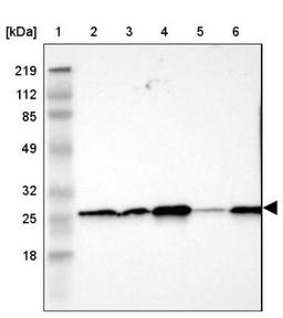 Western Blot: SNAP23 Antibody [NBP1-83162] - Lane 1: Marker [kDa] 219, 112, 85, 49, 32, 25, 18<br/>Lane 2: Human cell line RT-4<br/>Lane 3: Human cell line U-251MG sp<br/>Lane 4: Human cell line A-431<br/>Lane 5: Human liver tissue<br/>Lane 6: Human tonsil tissue