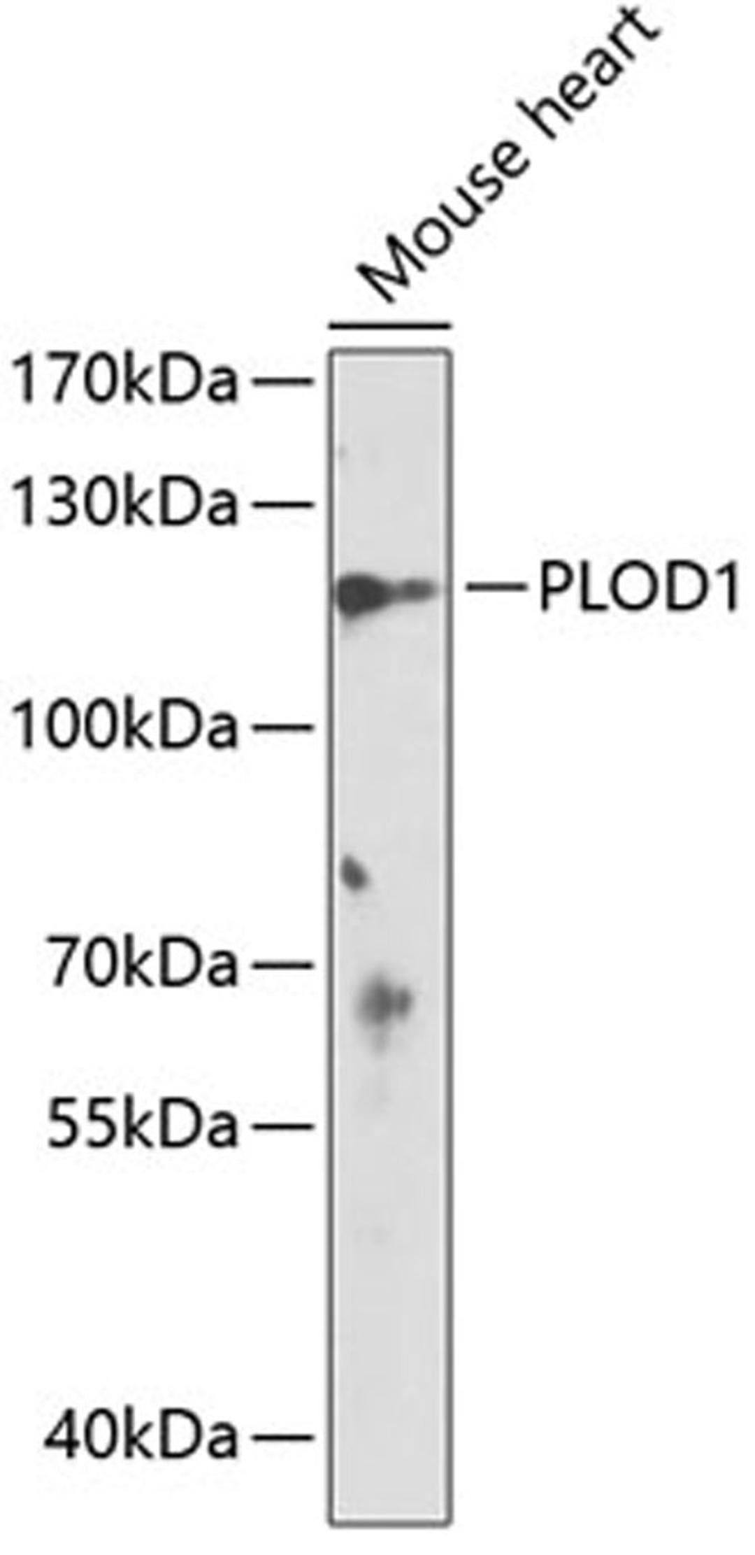 Western blot - PLOD1 antibody (A14044)