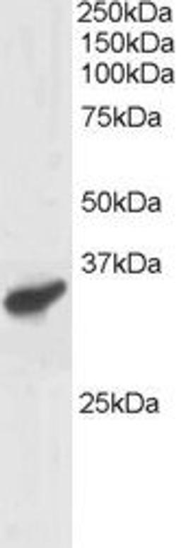 46-309 staining (1ug/ml) of Human Heart lysate (RIPA buffer, 30ug total protein per lane). Primary incubated for 1 hour. Detected by western blot using chemiluminescence.