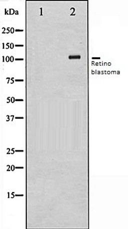 Western blot analysis of K562 whole cell lysates using Retinoblastoma antibody, The lane on the left is treated with the antigen-specific peptide.