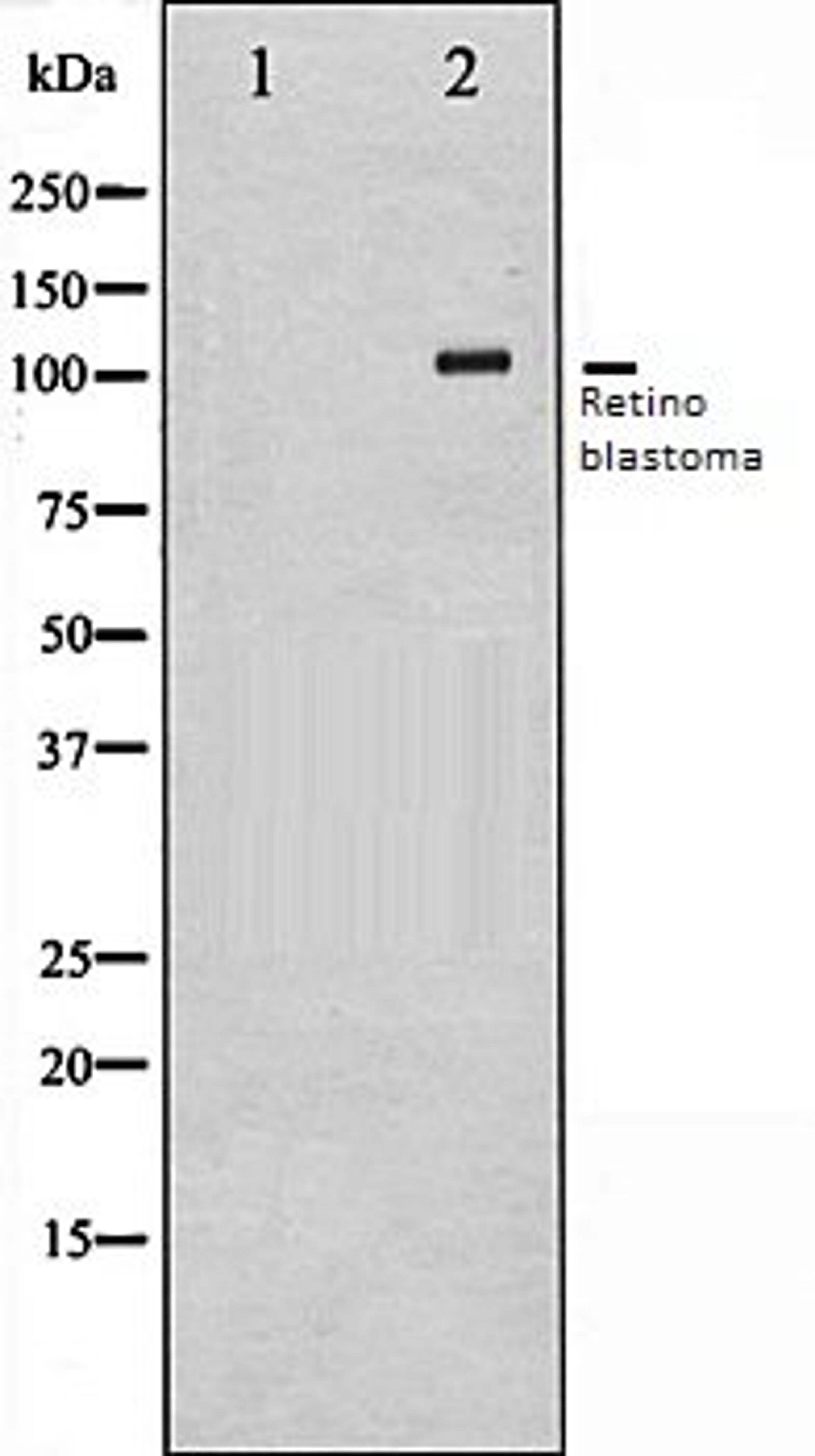 Western blot analysis of K562 whole cell lysates using Retinoblastoma antibody, The lane on the left is treated with the antigen-specific peptide.