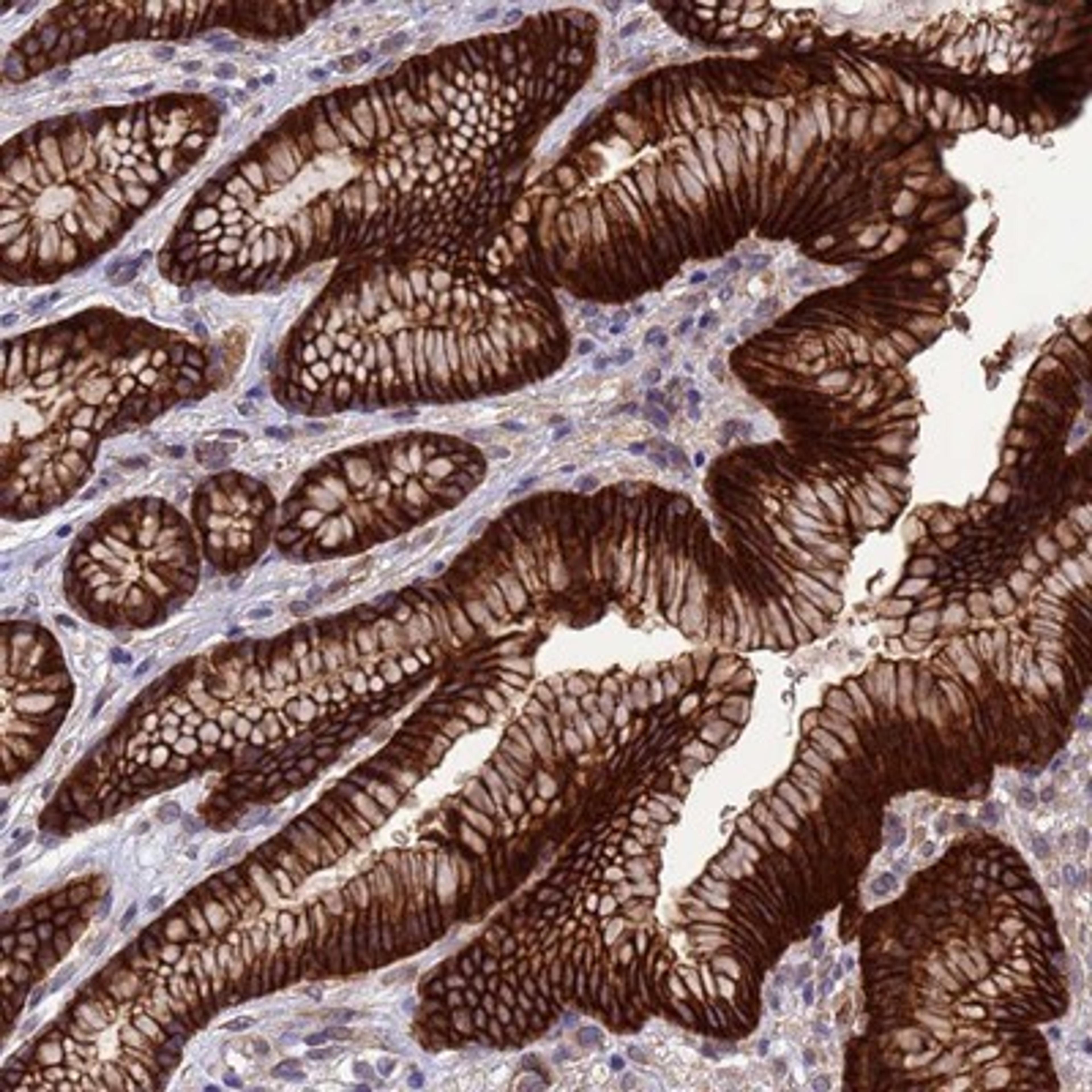 Immunohistochemistry-Paraffin: ARHGAP12 Antibody [NBP1-91678] - Staining of human stomach, upper shows strong cytoplasmic and membranous positivity in glandular cells.