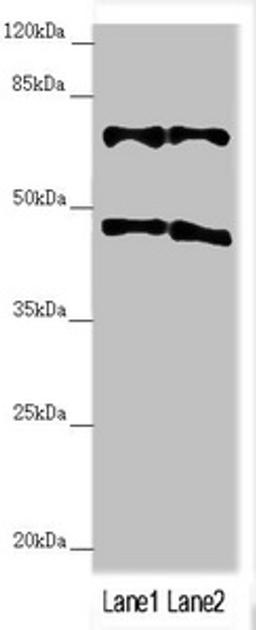 Western blot. All lanes: TRIM31 antibody at 4.98 ug/ml. Lane 1: HepG2 whole cell lysate. Lane 2: Hela whole cell lysate. Secondary. Goat polyclonal to rabbit IgG at 1/10000 dilution. Predicted band size: 49, 31 kDa. Observed band size: 49, 70 kDa. 