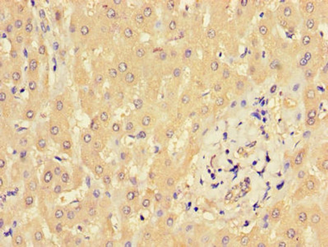 Immunohistochemistry of paraffin-embedded human liver tissue using CSB-PA659641LA01HU at dilution of 1:100