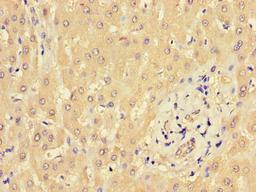 Immunohistochemistry of paraffin-embedded human liver tissue using CSB-PA659641LA01HU at dilution of 1:100