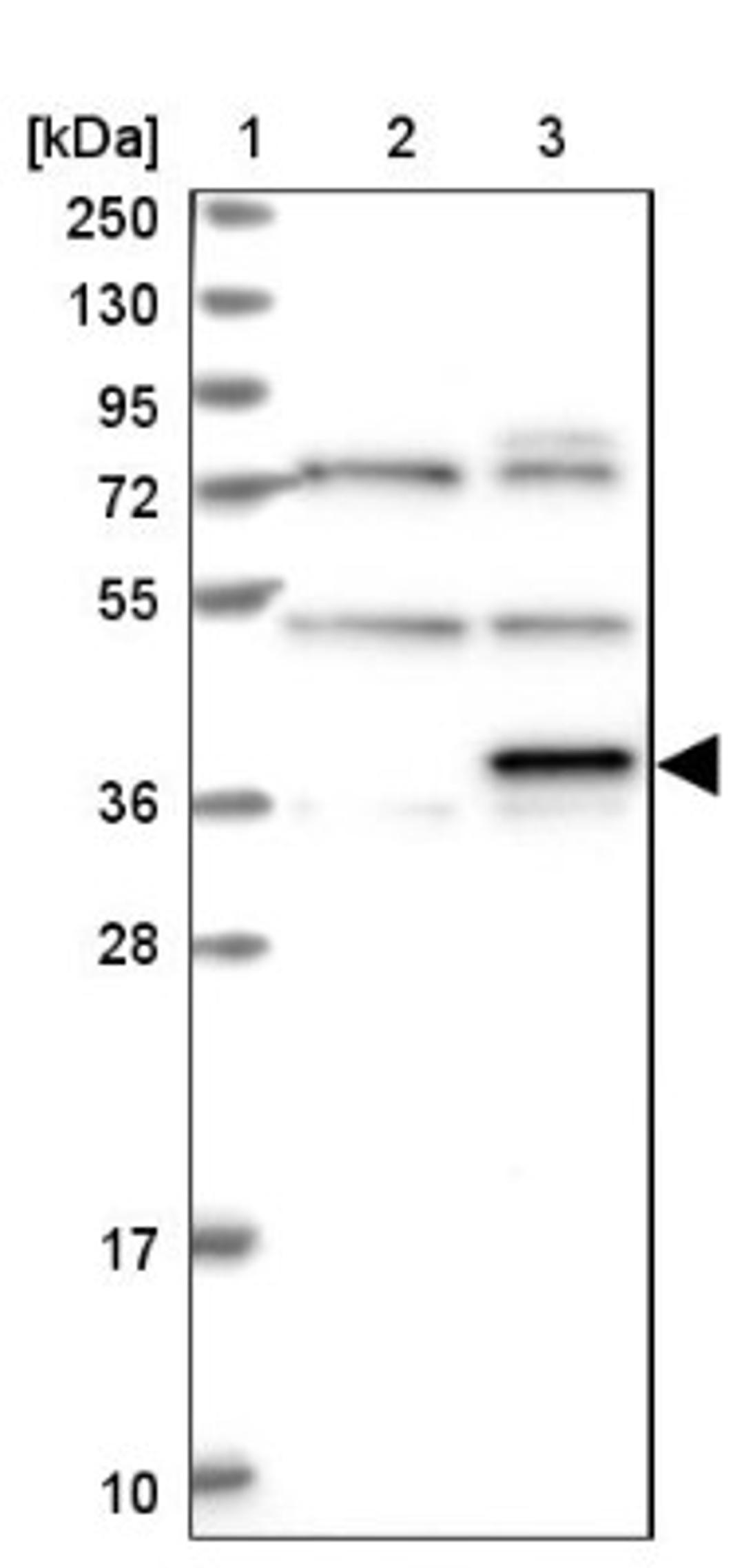 Western Blot: MAGEB6 Antibody [NBP1-84353] - Lane 1: Marker [kDa] 250, 130, 95, 72, 55, 36, 28, 17, 10<br/>Lane 2: Human cell line RT-4<br/>Lane 3: Human cell line U-251MG sp