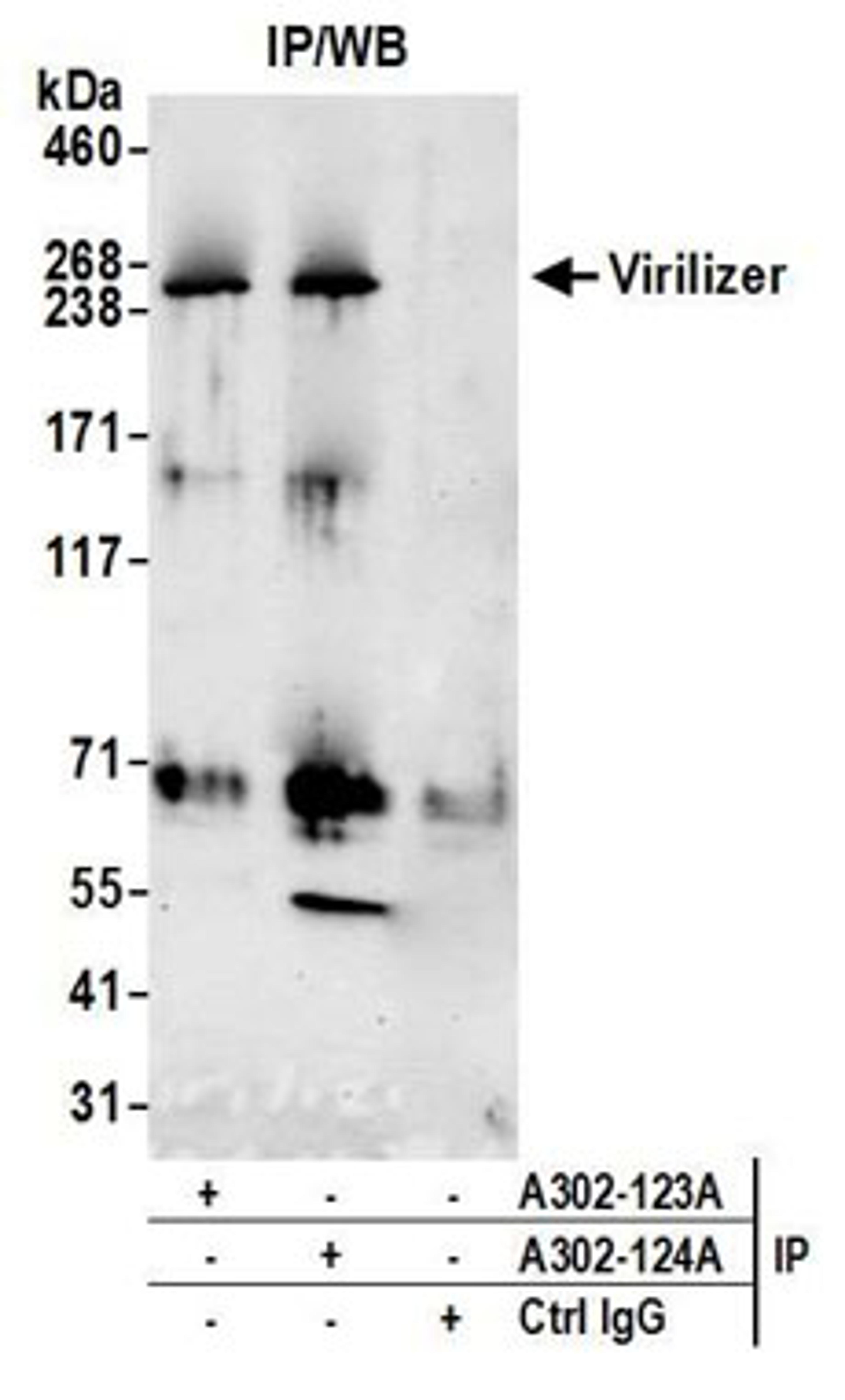 Detection of human Virilizer by western blot of immunoprecipitates.