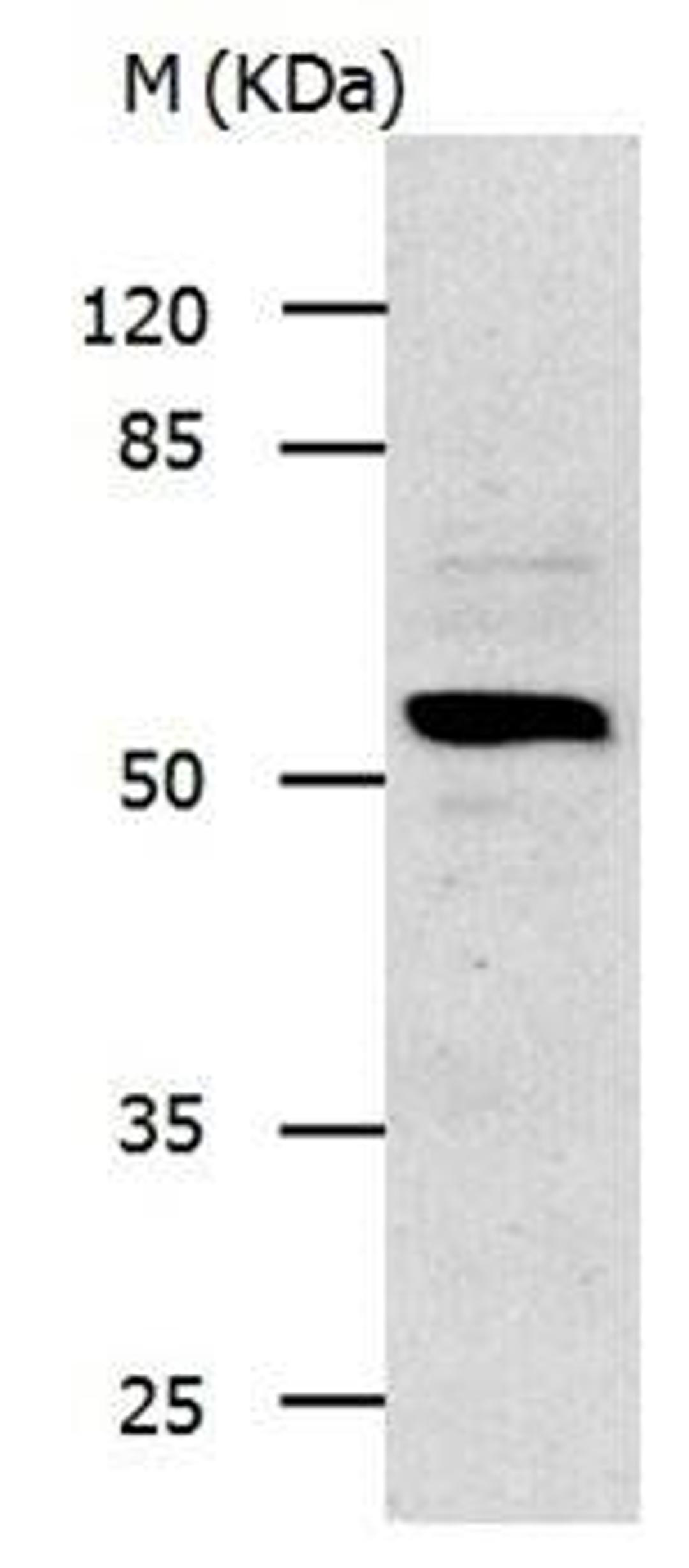 Western blot analysis of Gel: 8%SDS-PAGE (20ug lysate) at:1:500 dilution using IL13RA1 antibody