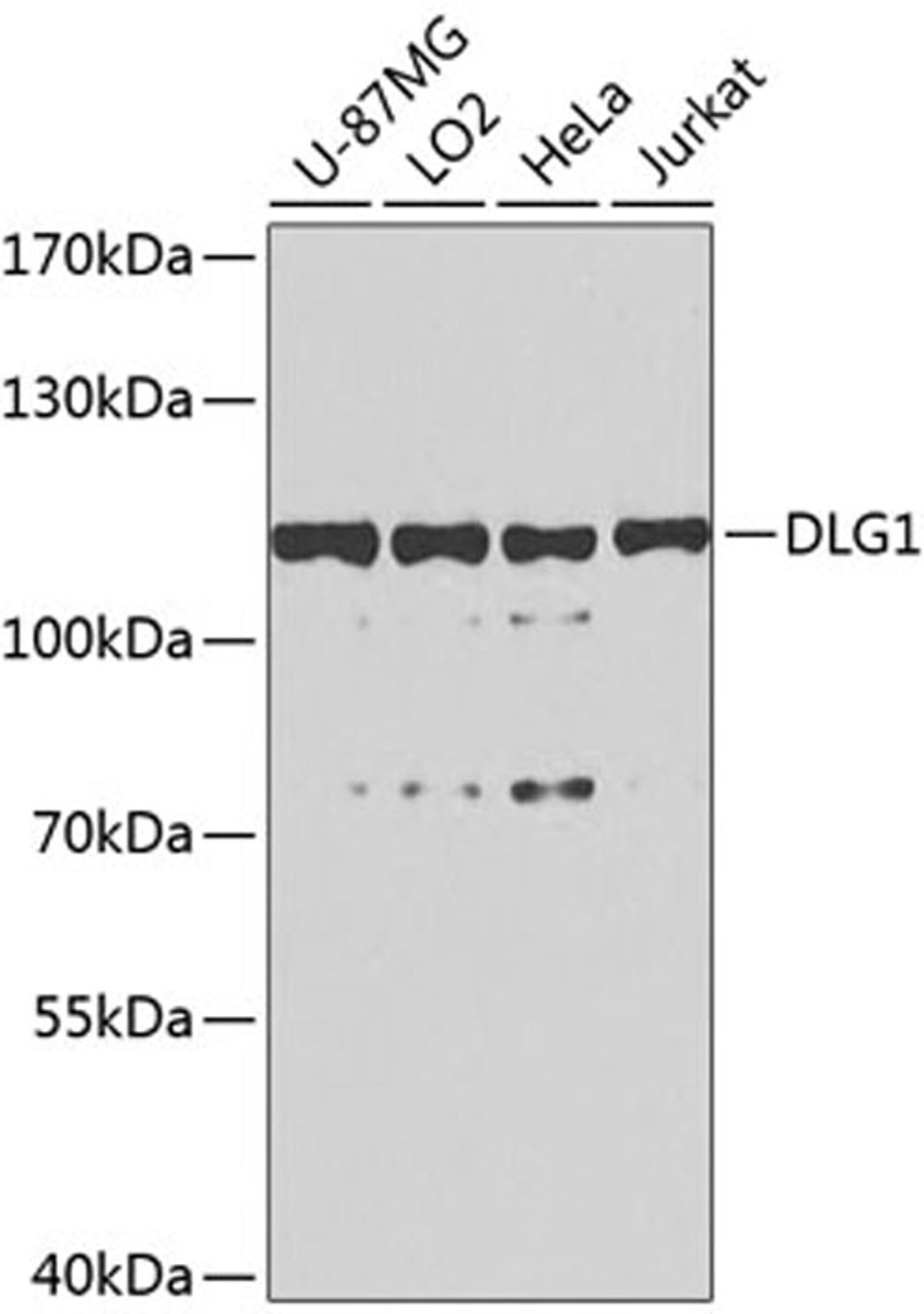 Western blot - DLG1 antibody (A8542)