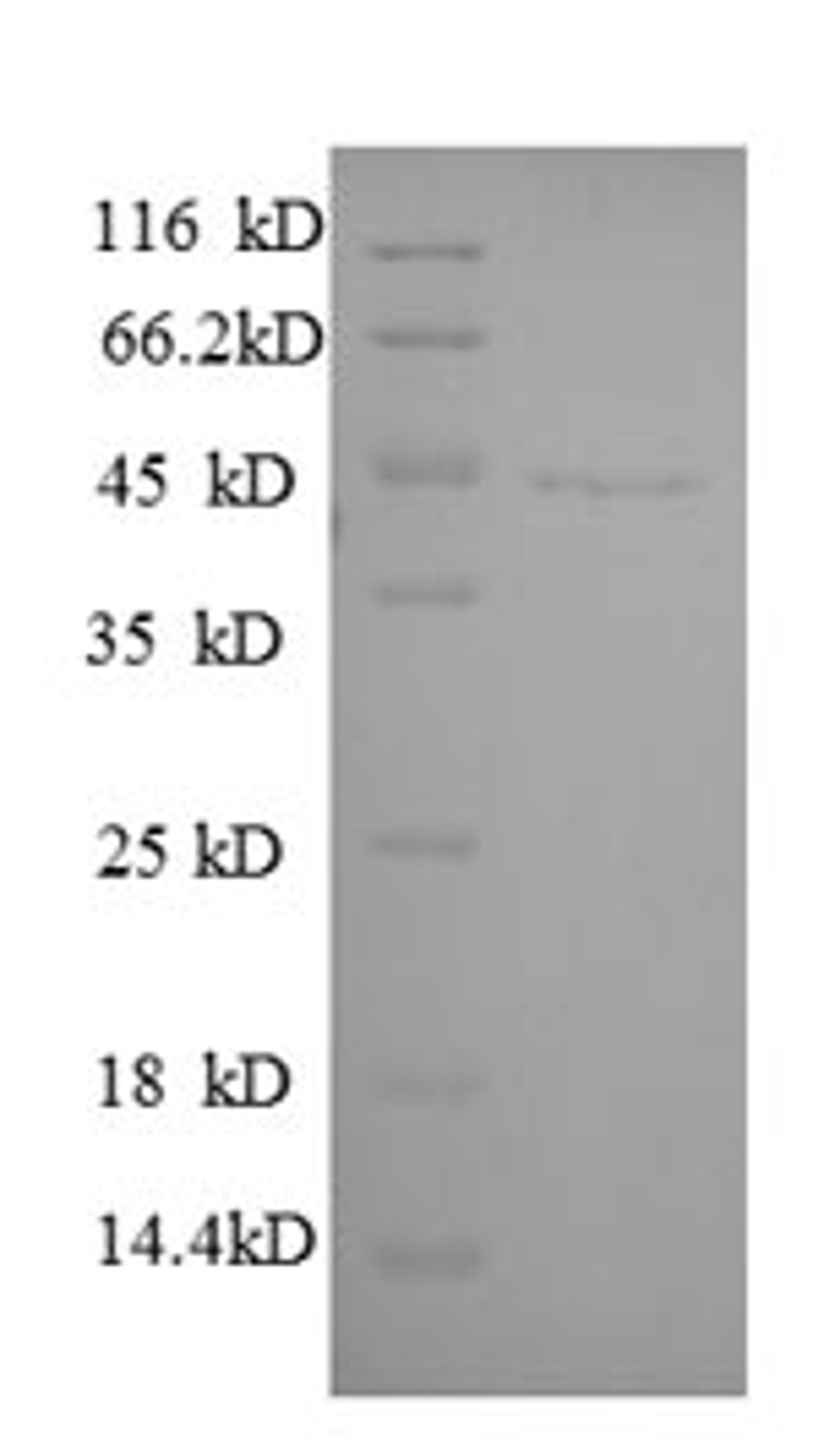 (Tris-Glycine gel) Discontinuous SDS-PAGE (reduced) with 5% enrichment gel and 15% separation gel.