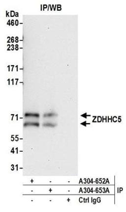 Detection of human ZDHHC5 by western blot of immunoprecipitates.