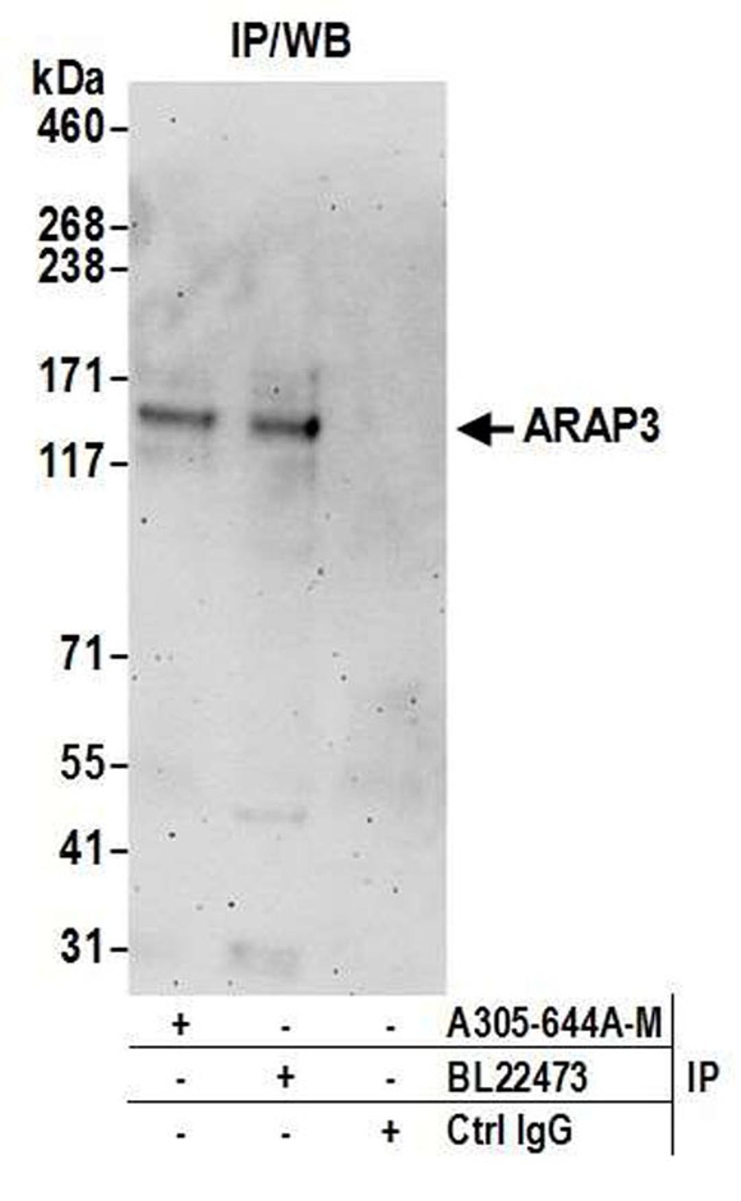 Detection of human ARAP3 by WB of IP.