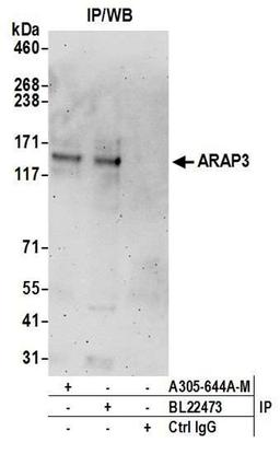 Detection of human ARAP3 by WB of IP.