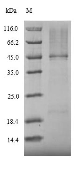 (Tris-Glycine gel) Discontinuous SDS-PAGE (reduced) with 5% enrichment gel and 15% separation gel.