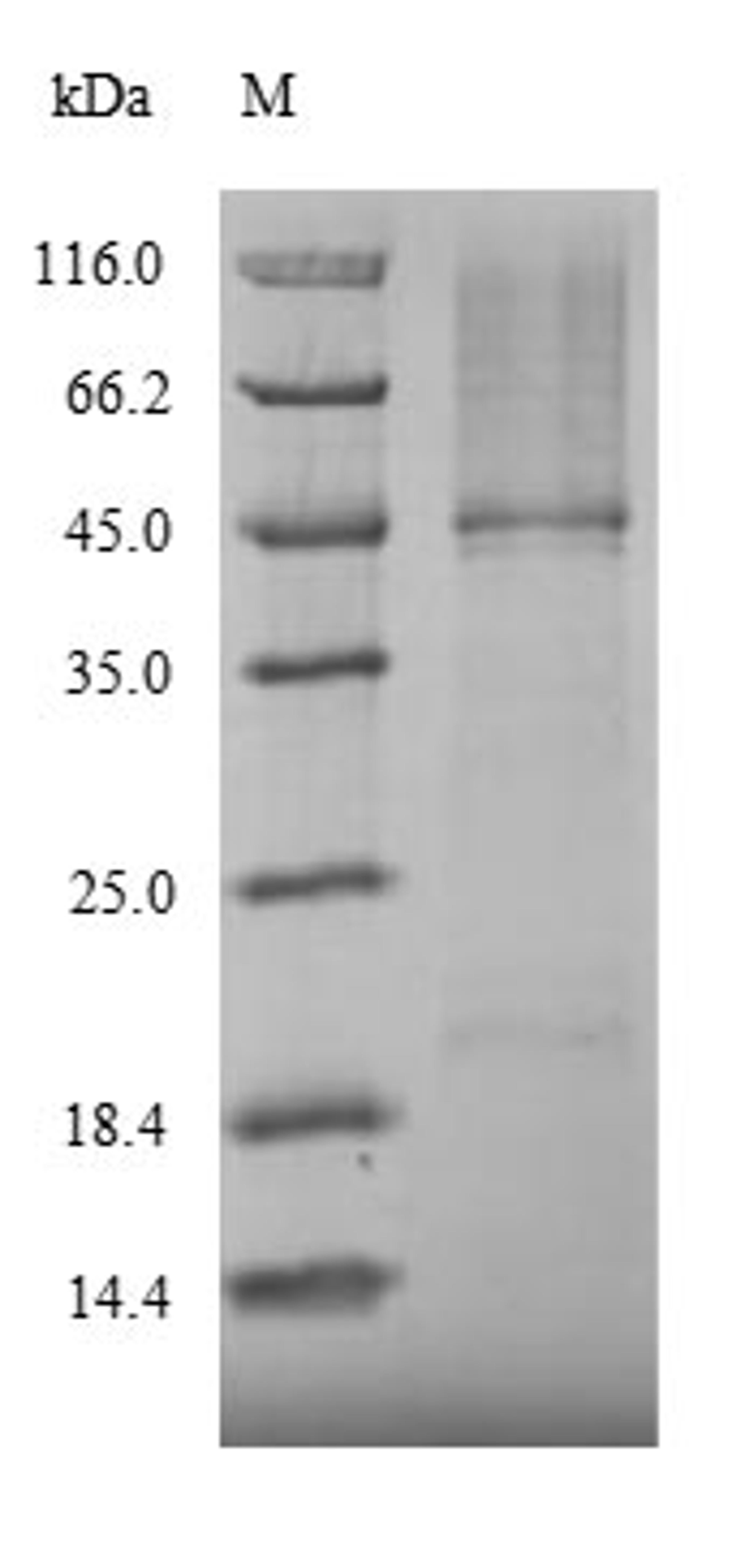 (Tris-Glycine gel) Discontinuous SDS-PAGE (reduced) with 5% enrichment gel and 15% separation gel.