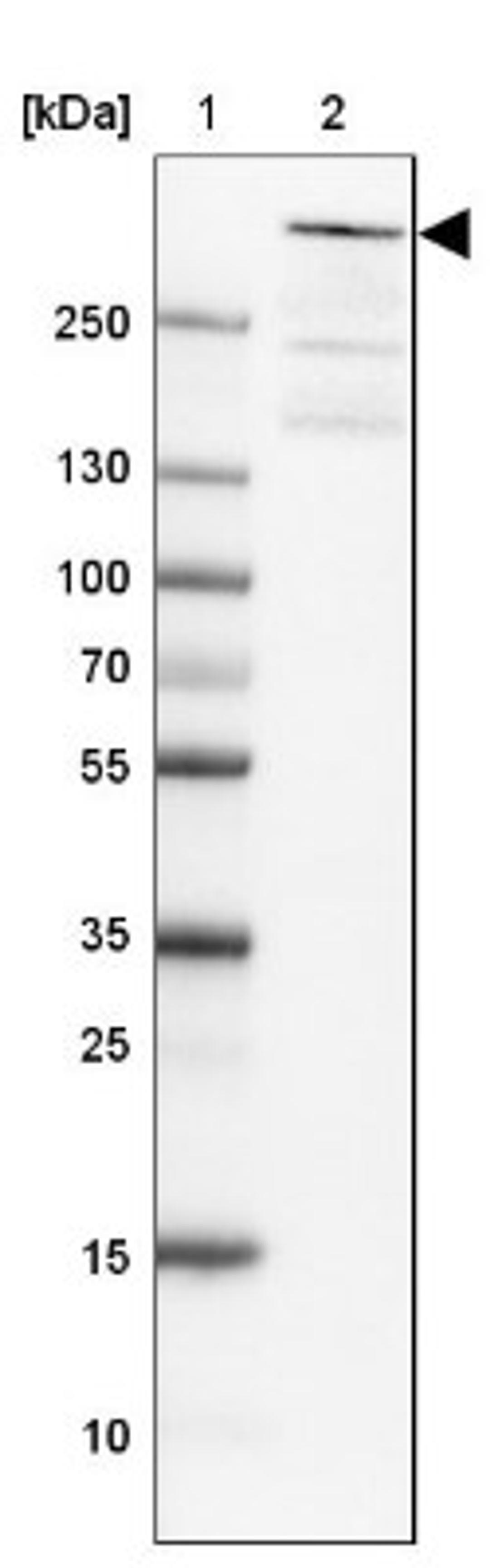 Western Blot: ATRX Antibody [NBP1-83077] - Lane 1: Marker [kDa]<br/>Lane 2: Human cell line A-549