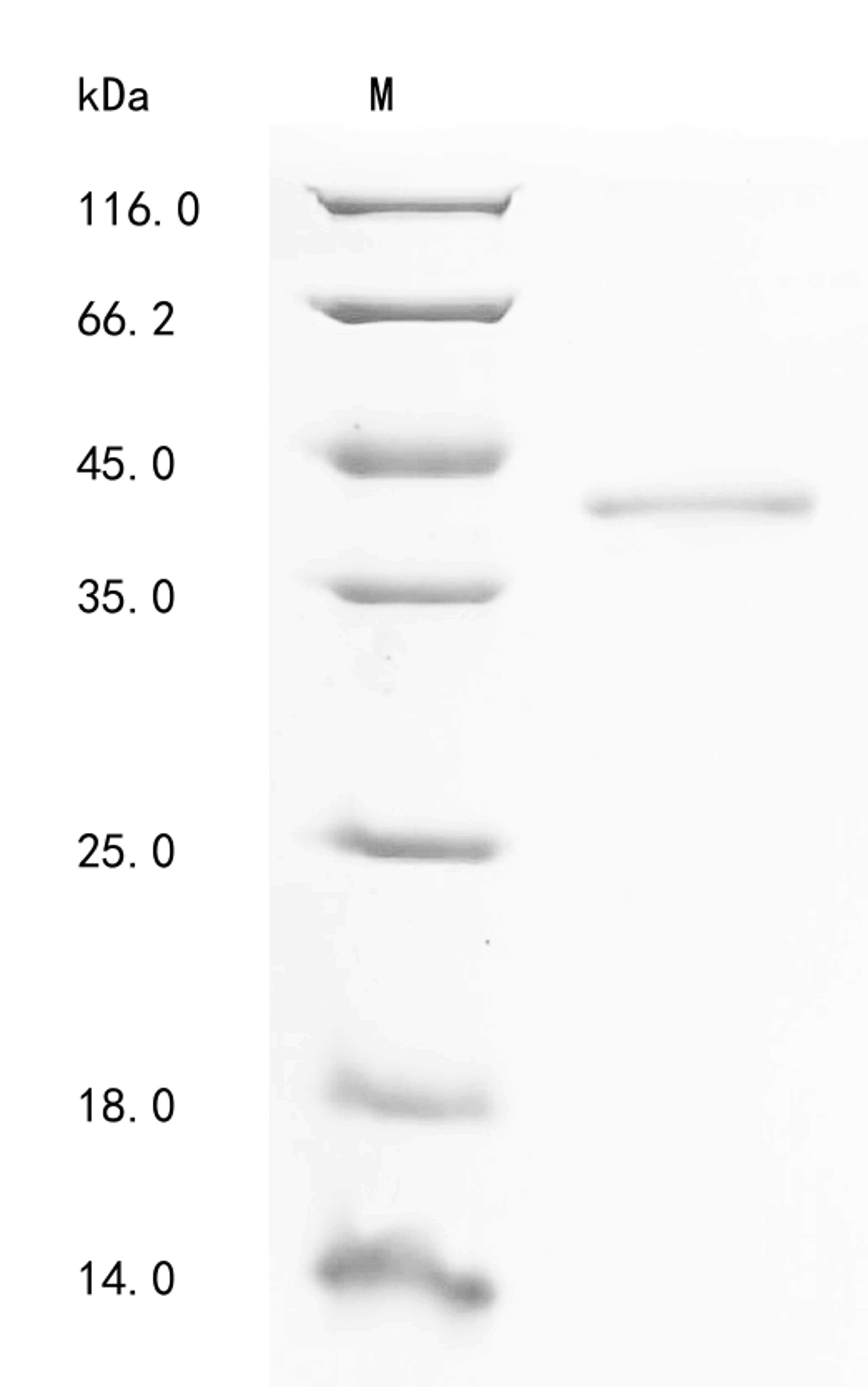 (Tris-Glycine gel) Discontinuous SDS-PAGE (reduced) with 5% enrichment gel and 15% separation gel.