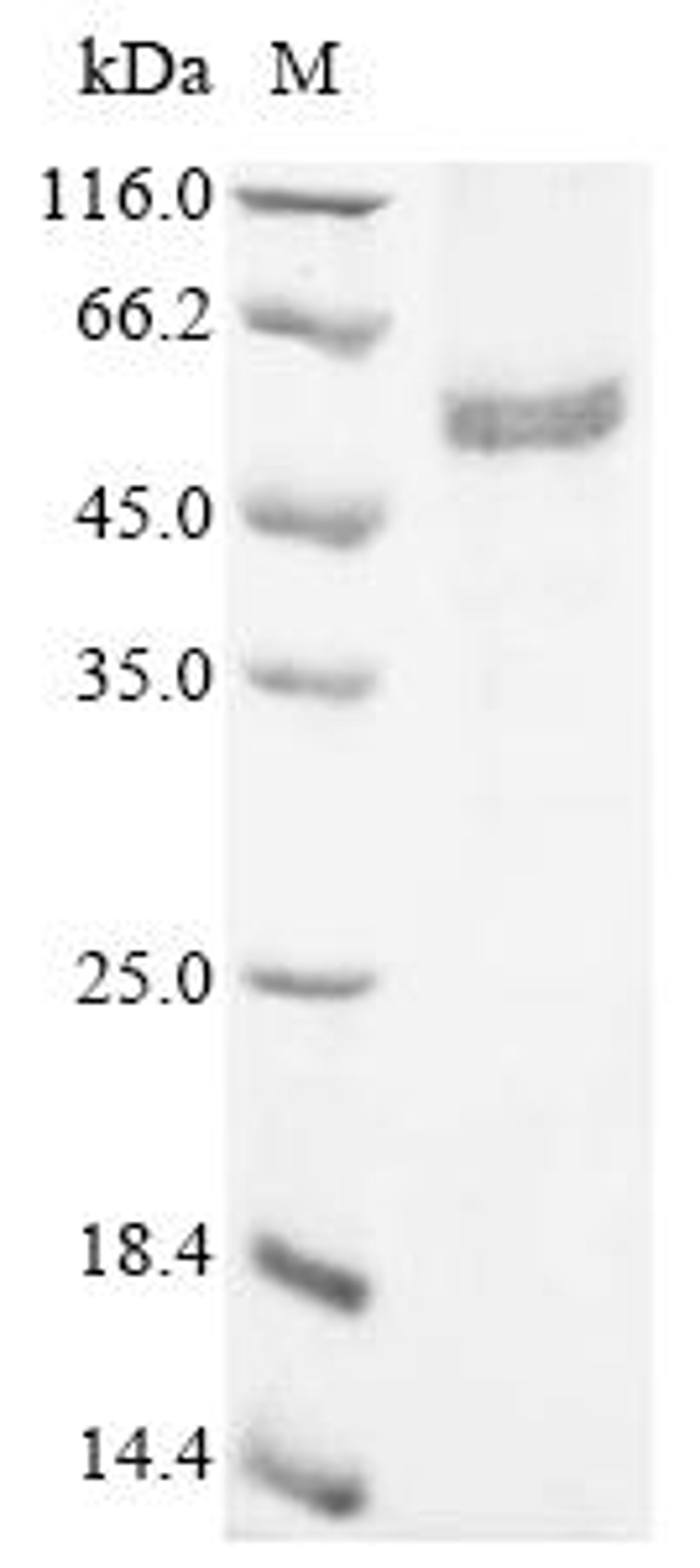 (Tris-Glycine gel) Discontinuous SDS-PAGE (reduced) with 5% enrichment gel and 15% separation gel.