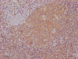 IHC image of CSB-MA996413 diluted at 1:100 and staining in paraffin-embedded human tonsil tissue performed on a Leica BondTM system. After dewaxing and hydration, antigen retrieval was mediated by high pressure in a citrate buffer (pH 6.0). Section was blocked with 10% normal goat serum 30min at RT. Then primary antibody (1% BSA) was incubated at 4°C overnight. The primary is detected by a Goat anti-mouse IgG polymer labeled by HRP and visualized using 0.05% DAB.