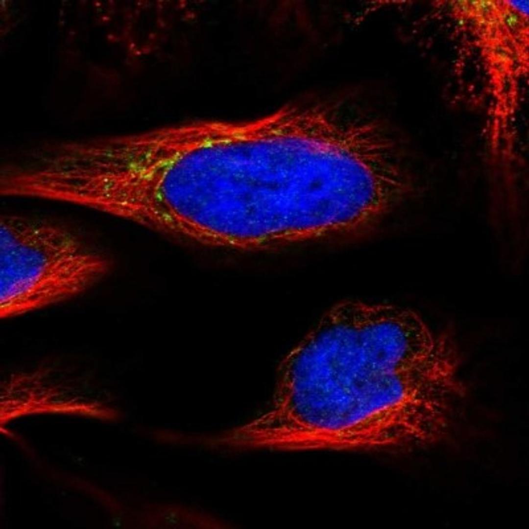 Immunofluorescence: VPS37C Antibody [NBP1-83632] - Staining of human cell line U-2 OS shows positivity in vesicles.